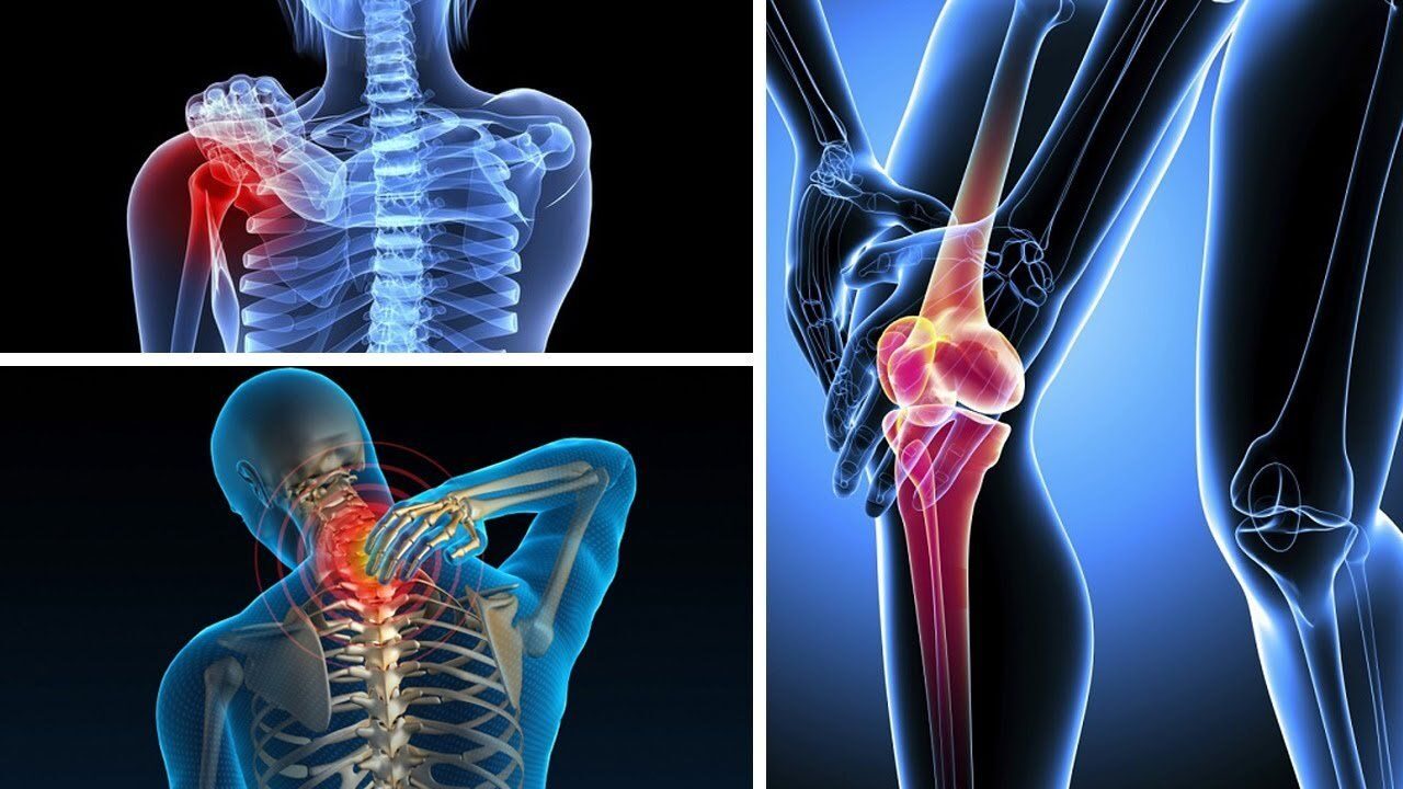 Đau Nhức Xương Khớp Uống Thuốc Gì?