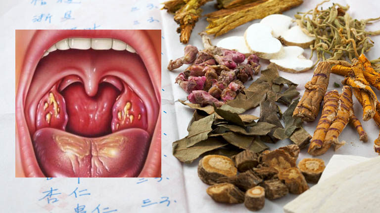 Đông y có chữa được bệnh mãn tính không?