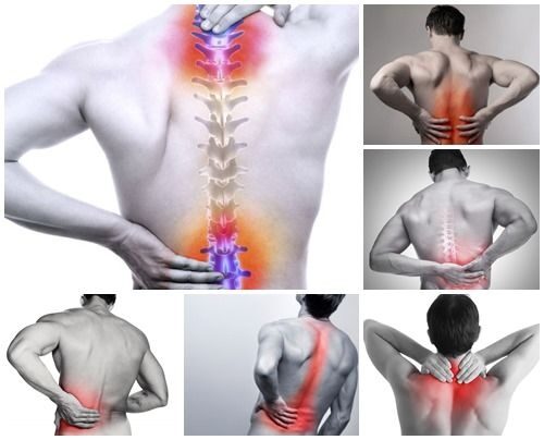 Thoái Hóa Cột Sống Điều Trị Bằng Đông Y Được Không?