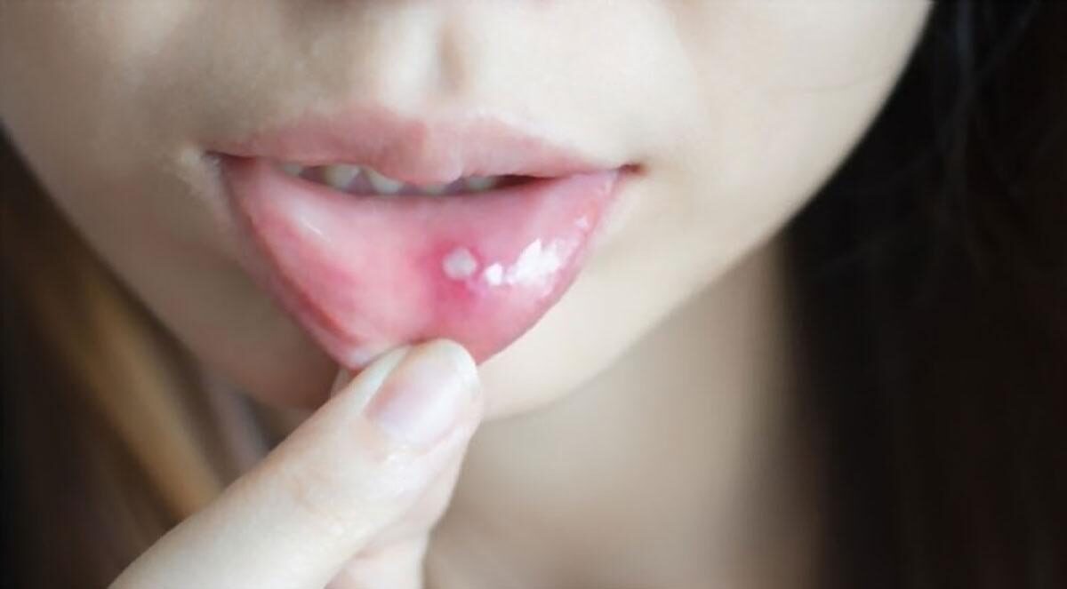 Thuốc đông y có gây nóng trong người không?